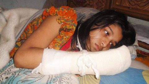 Illiterate husband snatched away all fingers for jealousy of wife's degree