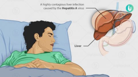 hepatitis a symptoms causes diagnosis prevention treatment