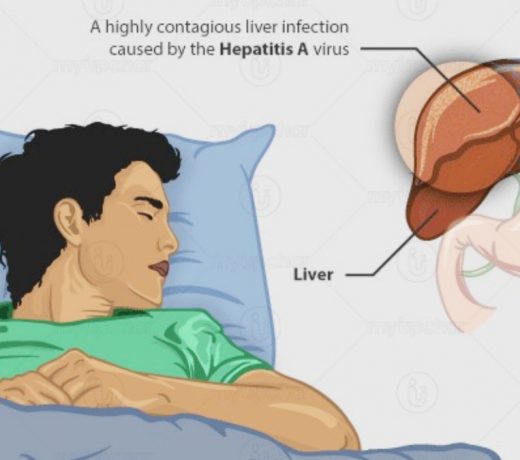 ‘जिंदगी अनलॉक’ हेपेटाइटिस ए का उच्च जोखिम: तैयार रहें, समय पर टीकाकरण करें
