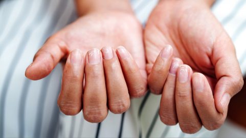 iron deficient body Symptoms