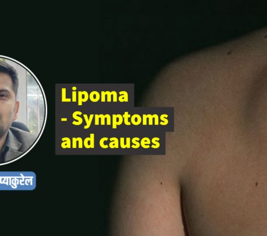 क्रिकेटर संदीप लामिछाने लाइपोमा बीमारी : यह किस प्रकार की बीमारी है ?