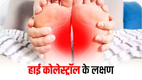 high cholesterol symptoms