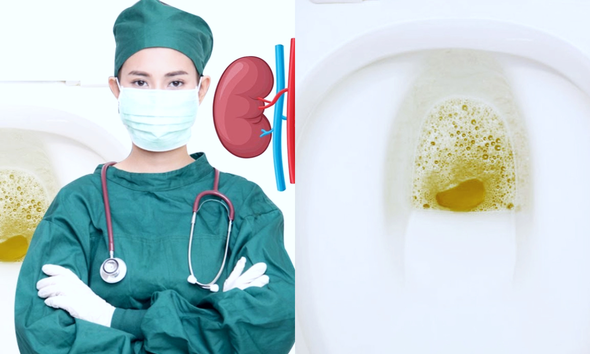 Foaming in the urine is a serious disease