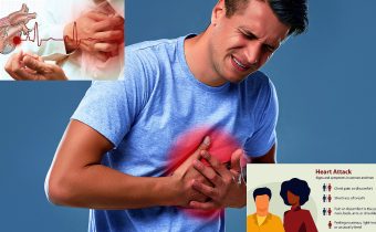 Heart AttackHeart Attack Signs and Symptoms, Risk factors