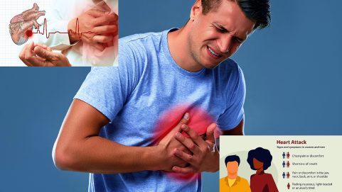Heart AttackHeart Attack Signs and Symptoms, Risk factors