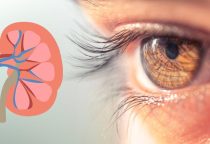 Don’t Ignore These 4 Eye Symptoms : They Could Be Warning Signs of Kidney Failure