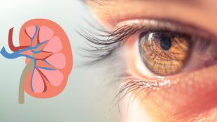 Don’t Ignore These 4 Eye Symptoms : They Could Be Warning Signs of Kidney Failure