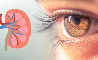 Don’t Ignore These 4 Eye Symptoms : They Could Be Warning Signs of Kidney Failure