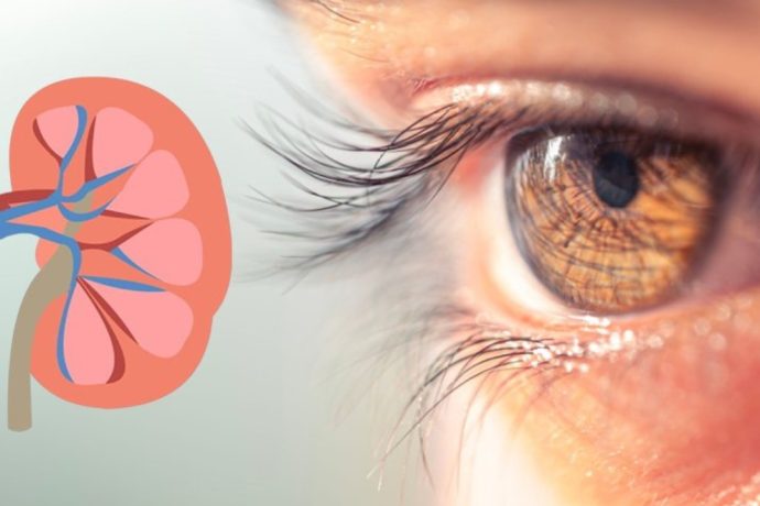 Don’t Ignore These 4 Eye Symptoms : They Could Be Warning Signs of Kidney Failure